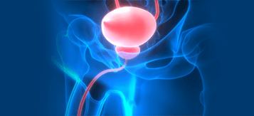urinary bladder cancer treatment india